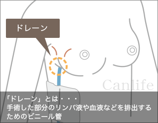 ドレーンの説明図